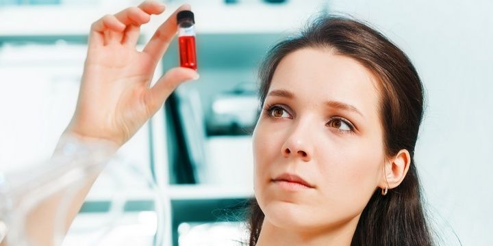 5 Symptoms of Individuals Diagnosed with Lupus Abnormal Blood Tests and Anemia